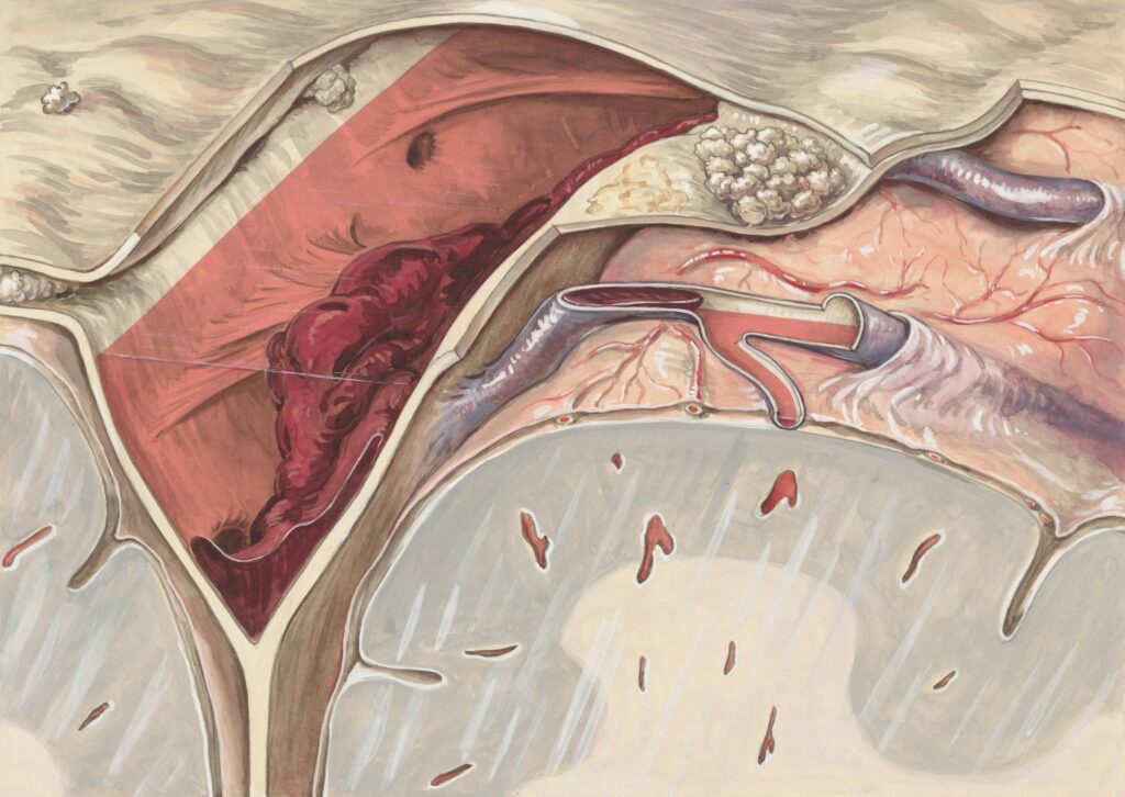 Early vascular access planning